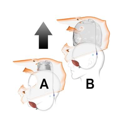 Simpson Safety - Simpson Safety 0890-01-30 Helmet Eject Removal System