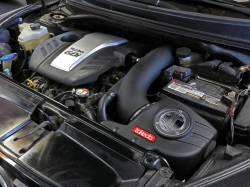 aFe Power - aFe Power 56-70028D Cold Air Intake for 13-17 Hyundai Veloster 1.6 - Image 8