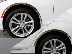 Quality Automotive Accessories - QAA WQ60210 4Pc Stainless Steel Wheel Well Trim for 2020-2025 Cadillac XT6 - Image 4