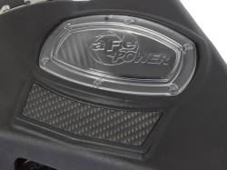 aFe Power - aFe 51-74209 Momentum GT Black Cold Air Intake for 13-19 Cadillac ATS 2.0L - Image 5